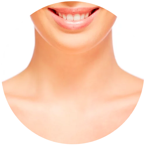 Cuello