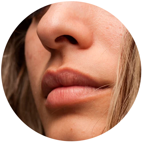 Bigote